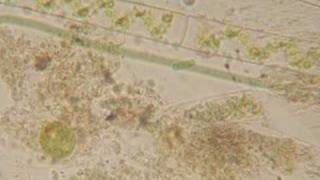 Microscope view of some pond scum