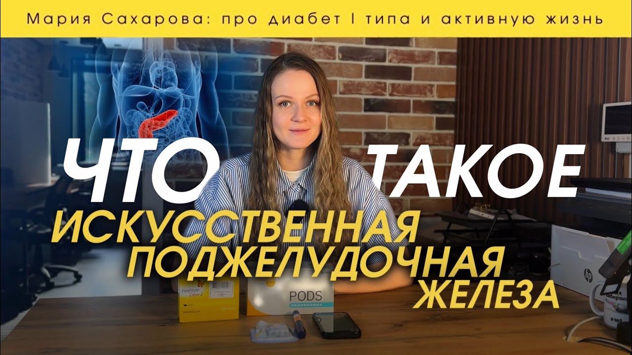 Что такое Искусственная поджелудочная железа для диабетиков: мой опыт и супер новость для России!