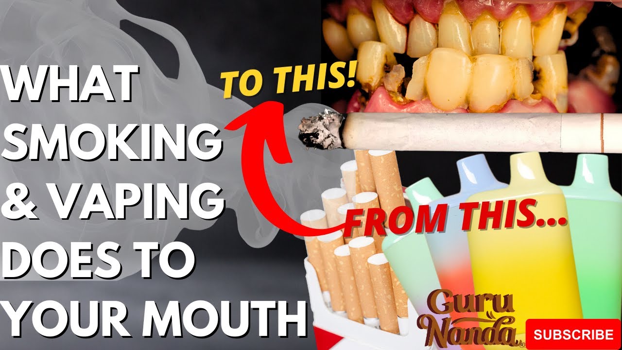 Is Smoking and Vaping Ruining YOUR Oral Health? - YouTube