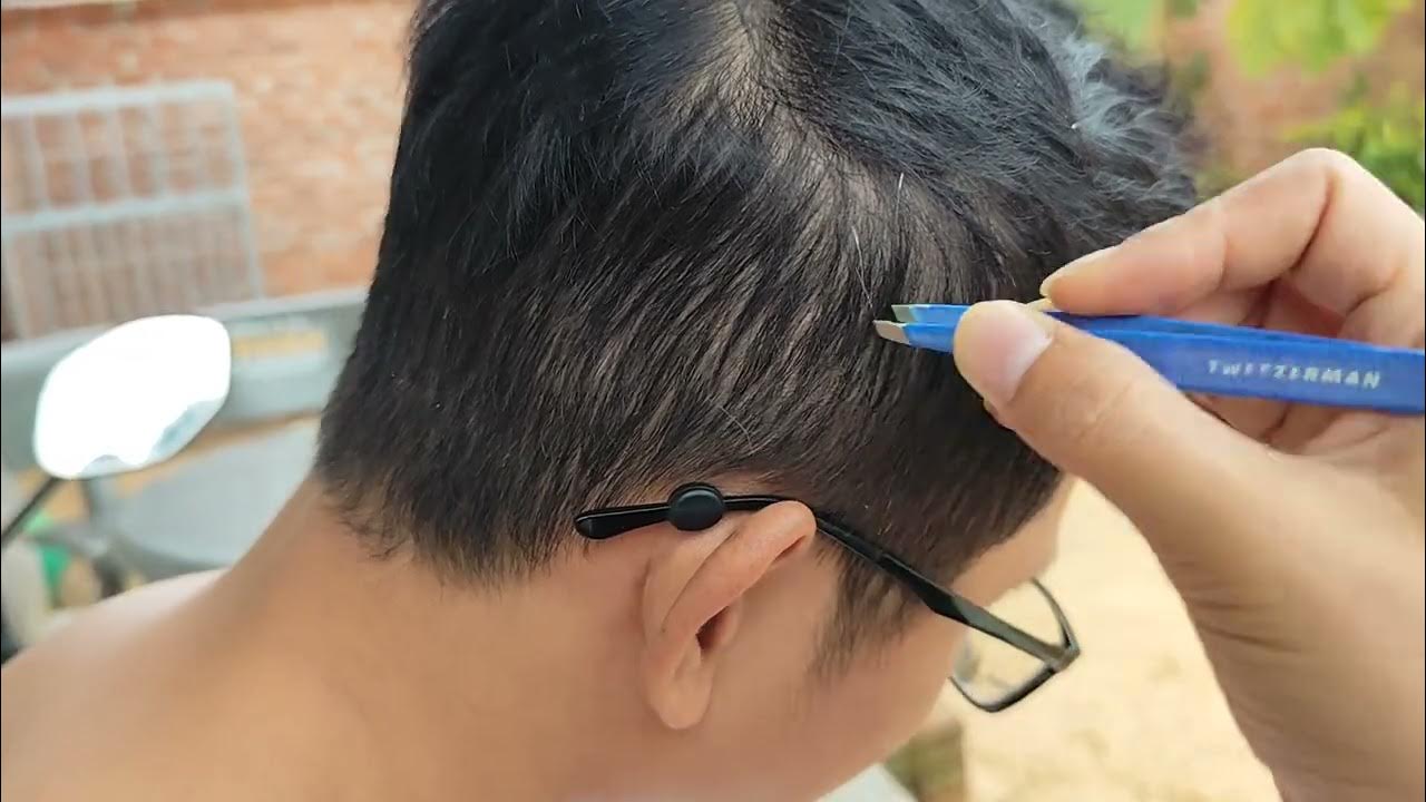 pluck-white-hair-removal-for-mr-ghhjjjhgfswwrtyiokmbcxadfghh-youtube