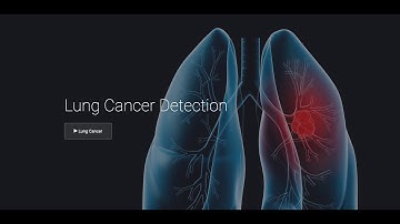 LUNG CANCER DETECTION USING CNN