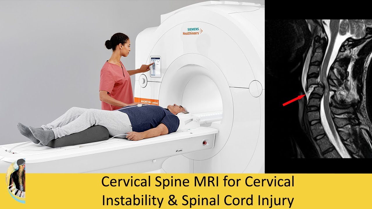 Боль в шее после аварии? Почему Рентген не видит Нестабильность