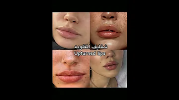 انت مانوع شفايفك اكسبلور ترند تيك توك تجميلية بشرة شفايف Aus 