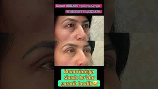 Qovoq olish | Қовоқ олиш | Blefaroplastika. Doctor ODILJON +998974347791 TOSHKENT VA JIZZAXDA #rek