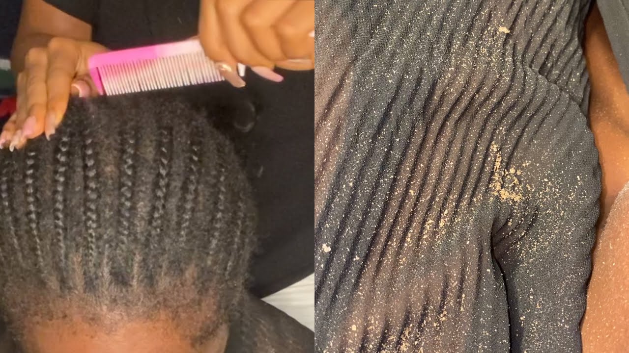 ALL IN ONE ASMR VIDEO: Scratching(with nails and tools), gum chewing and water sounds.