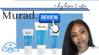 MURAD BLEMISH KIT REVIEW: 7 DAY BEFORE &amp; AFTER