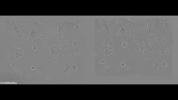 RA - Fiduciary-free frame alignment and image stabilization (left: raw, aligned: right)