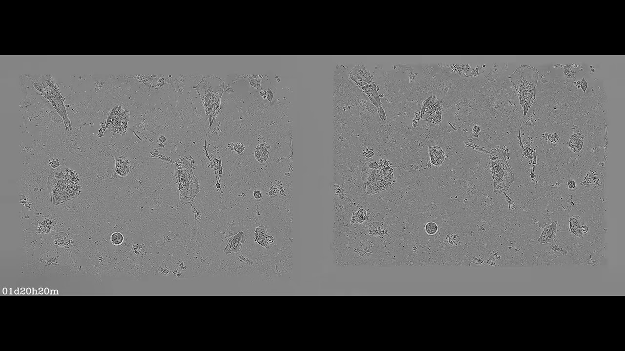 RA - Fiduciary-free frame alignment and image stabilization (left: raw, aligned: right)