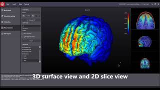 neurophet tES Lab