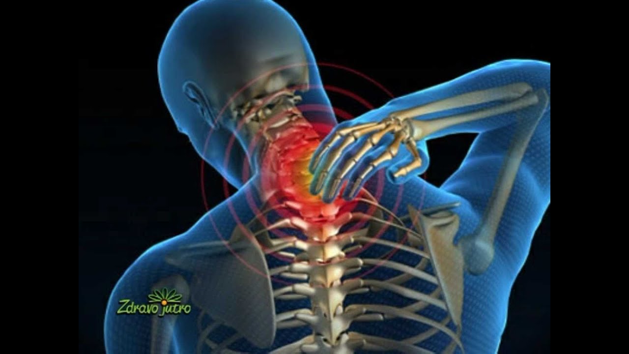vratna kralježnica i hipertenzija bol u sljepoočnicama hipertenzije