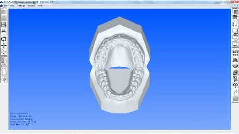 Orthotech 3 D Digital Model Viewer
