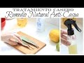 Tratamiento Casero para la Caspa | Remedio Natural Anti-Caspa