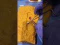 Experience the Realistic Tissue Dissection Model | ALDAVER Surgical Simulator