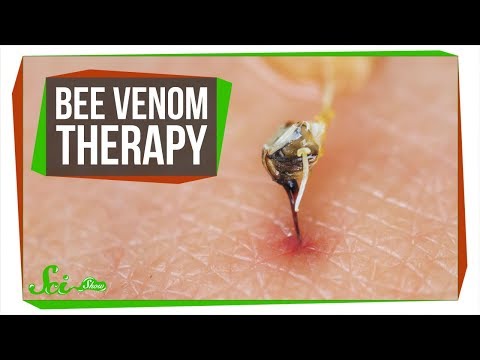 Video: Why A Bee Sting Is Dangerous