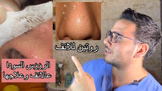 طرق ازاله الدهون و الرؤؤس السوداء علي الانف ؟