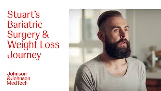 Stuarts Bariatric Surgery And Weight Loss Journey J&J Medtech