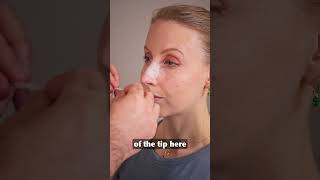 Nose Taping After Rhinoplasty: The Correct Technique in 60 Seconds for Better Results
