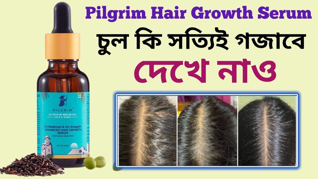 Pilgrim Redensyl 3% + Anagain 4% Advanced Hair Growth Serum Review In Bengali😍