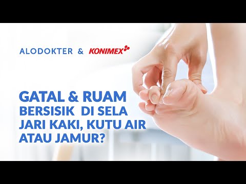 Video: Di sela-sela jari kaki gatal?