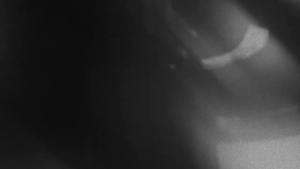 Watch Douglas Dare - Teardrop (Official Music Video) on YouTube Watch Douglas Dare - Teardrop (Official Music Video) on YouTube