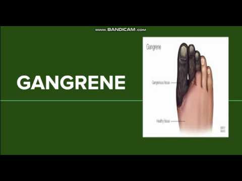 Video: Apatinių Galūnių Gangrena - Gangrenos Tipai Ir Simptomai