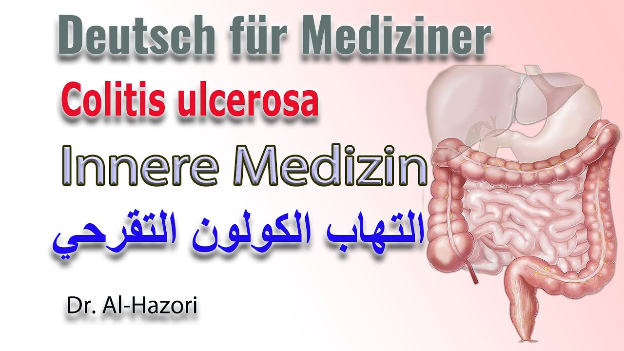 Colitis ulcerosa Deutsch M.D für Medizinerالتهاب الكولون التقرحي