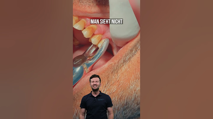Wie wird ein Zahn mit einer Zange gezogen? #shorts