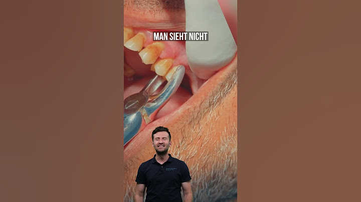 Wie wird ein Zahn mit einer Zange gezogen? #shorts