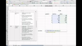 Which statistical test should I use?