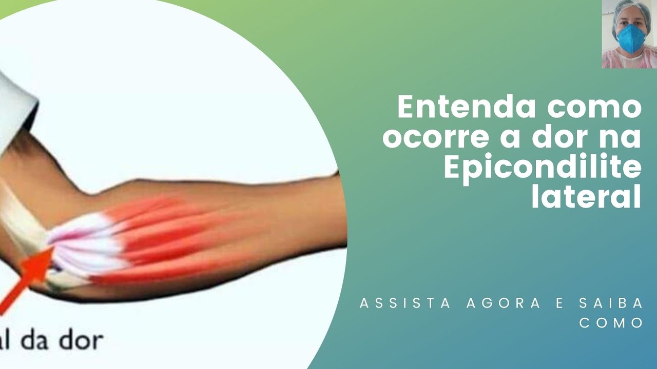 Entenda como ocorre a epicondilite lateral - YouTube
