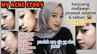MY ACNE STORY (6 tahun melawan jerawat gara2 cream pemutih) Tanpa perawatan dokter|| Novah Safitri