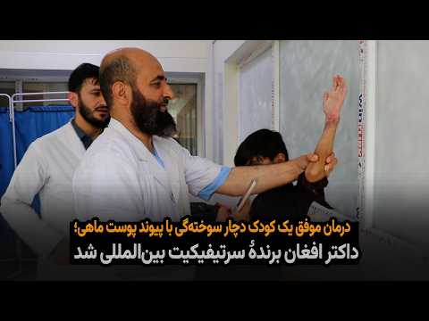 درمان موفق یک کودک دچار سوخته‌گی با پیوند پوست ماهی؛ داکتر افغان برندۀ سرتیفیکیت بین‌المللی شد