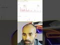 How to analyse Crypto Option | Part 03
