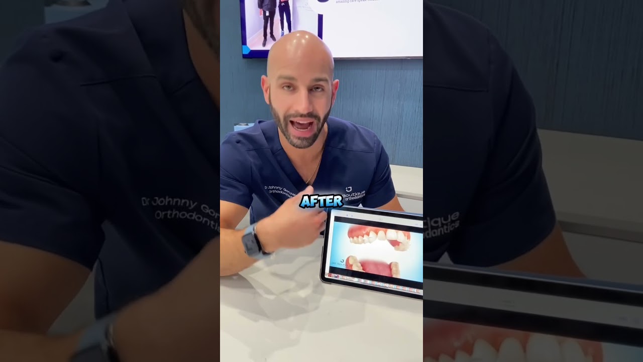 How Invisalign Works, in 25 Seconds.