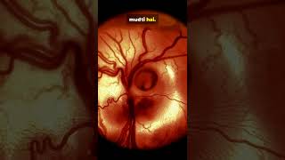 How Human Eye Works? 🔥 | Class 10 | #shorts