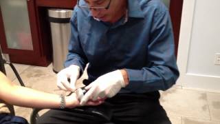 Treating Palmer (Hand) Hyperhidrosis with Botox near painlessly with cooling, Steve Weiner, MD