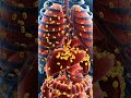 What If Your Immune System Turned Against You