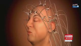 Scientists Demonstrate New ‘Mind Captioning’ System That Converts Brain Activity Into Text