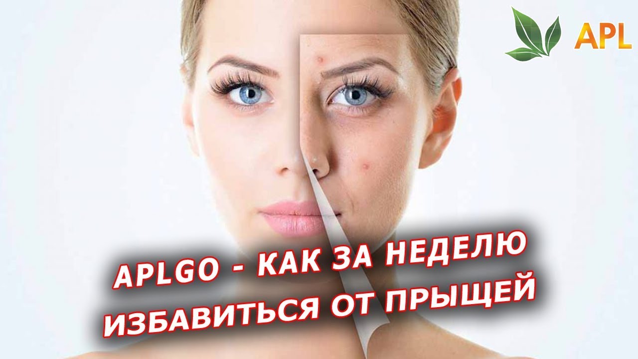 APLGO КАК ЗА НЕДЕЛЮ ИЗБАВИТЬСЯ ОТ ПРЫЩЕЙ! Результат употребления драже ...