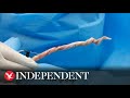 Artificial Tissue Restores Erectile Dysfunction In Pigs Artificial Tissue Restores Erectile Dysfunction In Pigs