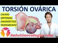 TORSIÓN OVÁRICA: CAUSAS, SÍNTOMAS, DIAGNÓSTICO, TRATAMIENTO... - Ginecología y Obstetricia -