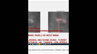 Active Contour Model Integrating Global and Local Information  - Matlab code -  Active Contour model