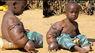 Maajabu ya mtoto mwenye mkono mkubwa kupitiliza | a baby with a giant arm