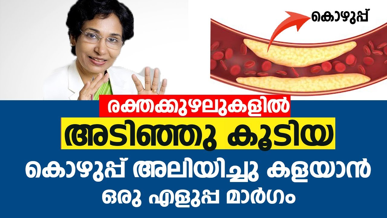 രക്തക്കുഴലുകളിൽ അടിഞ്ഞു കൂടിയ കൊഴുപ്പ് അലിയിച്ചു കളയാൻ | High Cholesterol & Triglyceride | Arogyam