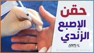 طريقة حقن الاصبع الزندى (تليفات حول الوتر القابض لاصبع الابهام)