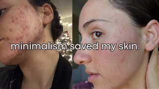 How I Cleared My Skin On A Simple Routine Minimalist Natural
