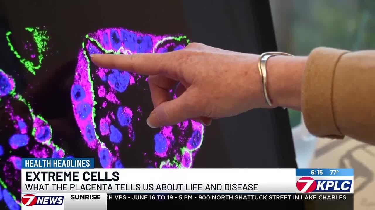 Extreme Cells: What the placenta tells us about life and disease