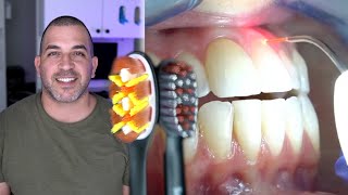 Gum Disease Periodontitis | Stop Bleeding Gums NOW!