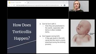 Optimal Therapy Torticollis Webinar