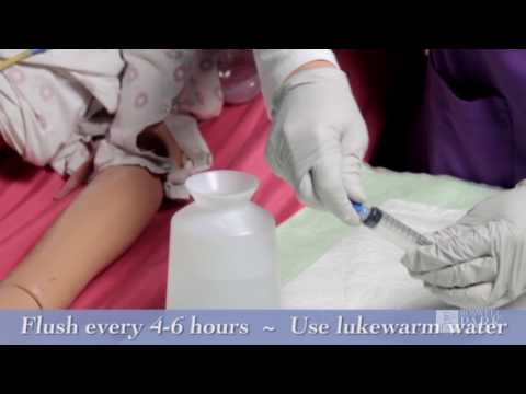 J Tube (Jejunostomy) Feeding Tube Care Instructions | Roswell Park Patient Education
